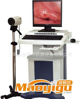 电子阴道镜诊断系统（普通型）/纤维胃镜/内窥镜/阴道镜