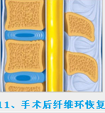 椎间孔镜最低价